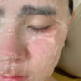 天然去斑方法