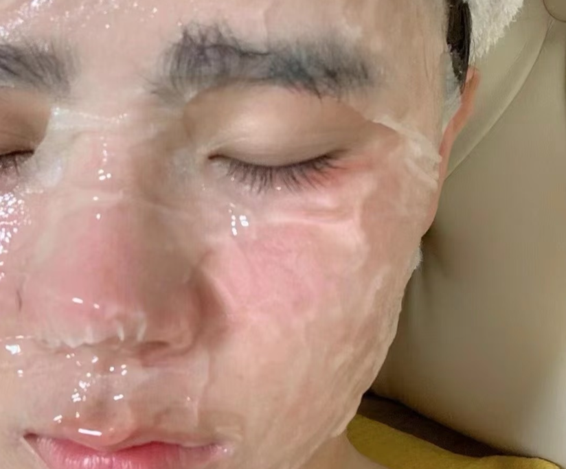 天然去斑方法